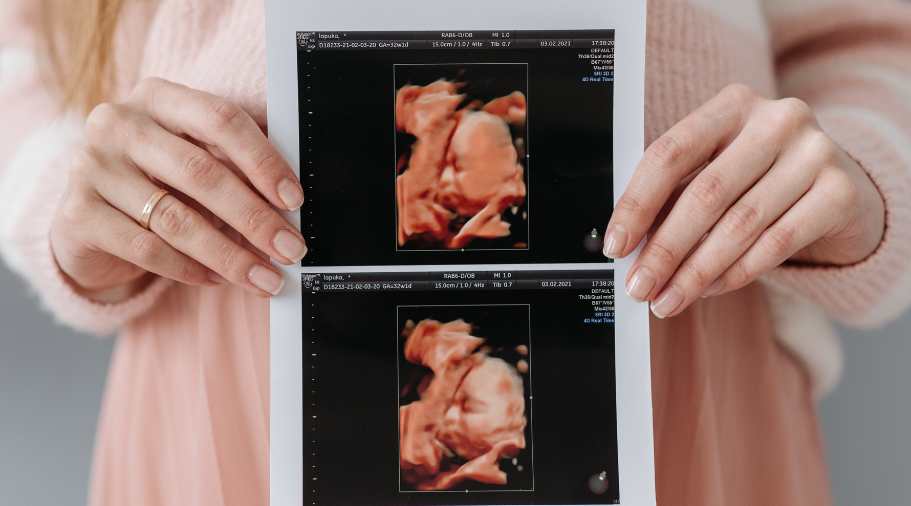 VIP 4D Ultrasound Scan | Hey Baby 4D East York